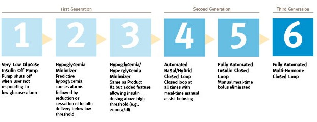 6 stages of "Artificial Pancreases"